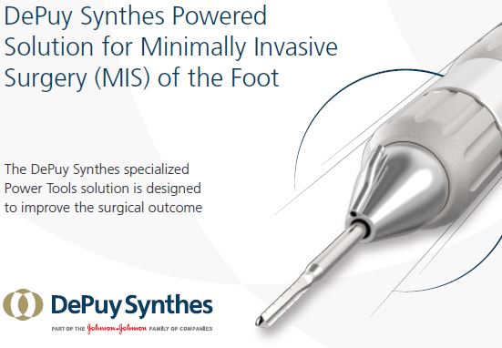 Powered Solution for Minimally Invasive Surgery (MIS) of the Foot - DePuy Synthes